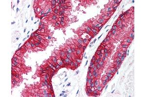 Anti-KCNN4 antibody IHC of human prostate.