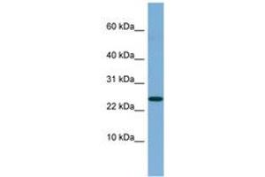 Image no. 1 for anti-Neuroblastoma 1, DAN Family BMP Antagonist (NBL1) (C-Term) antibody (ABIN6741850)