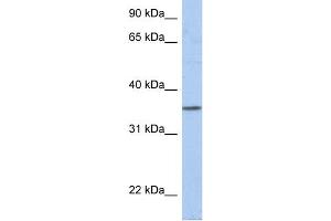 WB Suggested Anti-PRR18 Antibody Titration: 0. (Proline Rich 18 anticorps  (N-Term))