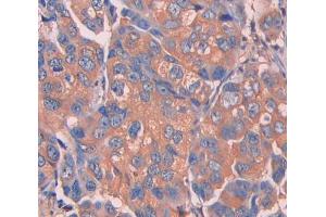 IHC-P analysis of Mouse Tissue, with DAB staining.