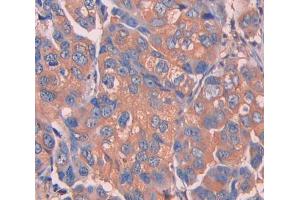 IHC-P analysis of Mouse Tissue, with DAB staining. (UCP1 anticorps  (AA 179-296))
