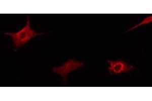 ABIN6267338 staining HeLa cells by IF/ICC.