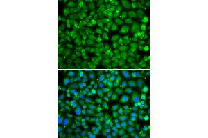 Immunofluorescence analysis of MCF-7 cells using SAT2 antibody. (SAT2 anticorps)