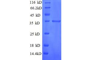 SDS-PAGE (SDS) image for Chemokine (C-X-C Motif) Ligand 10 (CXCL10) (AA 22-98) protein (GST tag) (ABIN5712672) (CXCL10 Protein (AA 22-98) (GST tag))