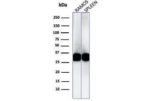 Western Blot Analysis of Ramos cell and human spleen lysate using HLA-DR Mouse Monoclonal Antibody (LN-3).