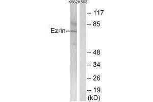 Western blot analysis of extracts from K562 cells, using Ezrin (Ab-478) antibody.