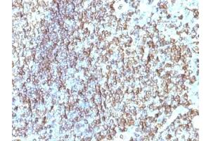 Formalin-fixed, paraffin-embedded human tonsil stained with HLA-DRB1 antibody (SPM288).