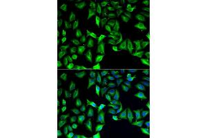 Immunofluorescence analysis of A549 cell using GDA antibody. (GDA anticorps)