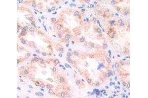 Used in DAB staining on fromalin fixed paraffin- embedded Kidney tissue