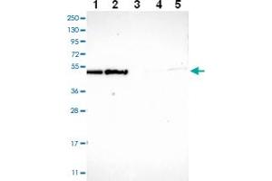 Western blot analysis of Lane 1: RT-4 Lane 2: U-251 MG Lane 3: Human Plasma Lane 4: Liver Lane 5: Tonsil with ECSIT polyclonal antibody ( Cat # PAB28035 ) at 1:100 - 1:250 dilution. (ECSIT anticorps)