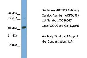WB Suggested Anti-KCTD9  Antibody Titration: 0. (KCTD9 anticorps  (Middle Region))