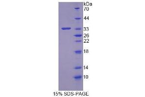 SDS-PAGE analysis of Human OSBP Protein. (OSBP Protéine)