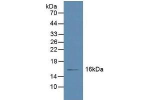 Detection of RBP5 in Human Liver Tissue using Polyclonal Antibody to Retinol Binding Protein 5, Cellular (RBP5) (Retinol Binding Protein 5 anticorps  (AA 2-135))