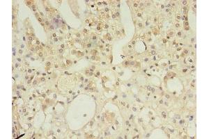 Immunohistochemistry of paraffin-embedded human adrenal gland tissue using ABIN7150209 at dilution of 1:100 (MSH6 anticorps  (AA 1-400))