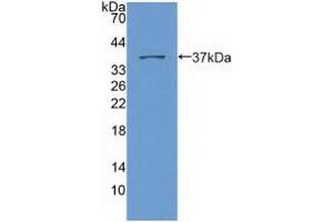 Figure. (SYNE2 anticorps  (AA 6-296))