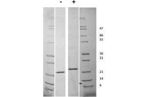 SDS-PAGE of Human Fibroblast Growth Factor-21 Recombinant Protein SDS-PAGE of Human Fibroblast Growth Factor-21 Recombinant Protein. (FGF21 Protéine)