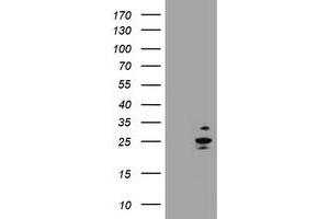 Image no. 1 for anti-RAB37, Member RAS Oncogene Family (RAB37) antibody (ABIN1500566) (RAB37 anticorps)