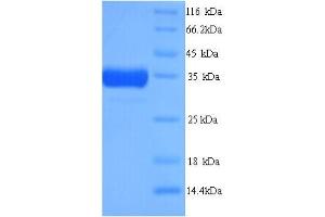 SDS-PAGE (SDS) image for Heme Oxygenase (Decycling) 1 (HMOX1) (AA 1-289), (full length) protein (His tag) (ABIN5713504)