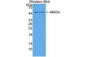 Detection of Recombinant LpPLA2, Mouse using Polyclonal Antibody to Phospholipase A2 Group VII (LpPLA2) (PLA2G7 anticorps  (AA 22-440))