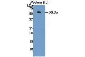 Western Blotting (WB) image for anti-CD46 (CD46) (AA 157-365) antibody (ABIN1859778) (CD46 anticorps  (AA 157-365))