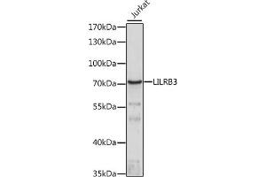 Western blot analysis of extracts of Jurkat cells, using LILRB3 antibody (ABIN7268239) at 1:1000 dilution. (LILRB3 anticorps  (AA 400-500))