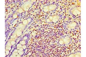 Immunohistochemistry of paraffin-embedded human colon tissue using ABIN7167365 at dilution of 1:100 (RAB6A anticorps  (AA 2-208))