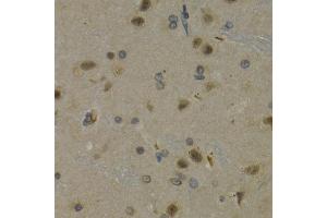 Immunohistochemistry of paraffin-embedded rat brain using MAX antibody at dilution of 1:200 (400x lens). (MAX anticorps)
