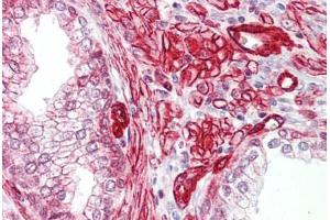 Anti-GAB2 antibody IHC staining of human prostate. (GAB2 anticorps  (AA 125-174))