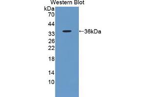 Figure. (AKAP12 anticorps  (AA 1485-1782))