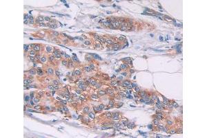 IHC-P analysis of Kidney tissue, with DAB staining. (TPM2 anticorps  (AA 1-284))