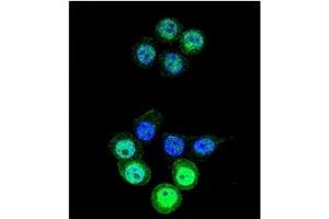 Image no. 1 for anti-Aldo-Keto Reductase Family 1, Member B1 (Aldose Reductase) (AKR1B1) (AA 287-316), (C-Term) antibody (ABIN357880)