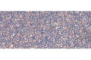 Immunohistochemistry of paraffin-embedded Human tonsil tissue using GALK2 Polyclonal Antibody at dilution of 1:95(x200) (GALK2 anticorps)