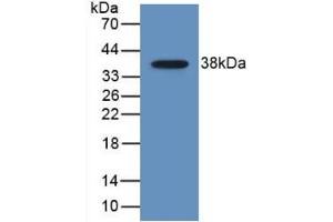 Detection of Recombinant MDC, Human using Monoclonal Antibody to Macrophage Derived Chemokine (MDC) (CCL22 anticorps  (AA 25-93))