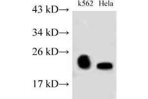 Western Blot analysis of K562 and Hela cells using RAB9A Polyclonal Antibody at dilution of 1:500 (RAB9A anticorps)