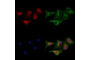 ABIN6266015 and ABIN6278800 staining Hela cells by IF/ICC. (MLL4 anticorps  (C-Term))