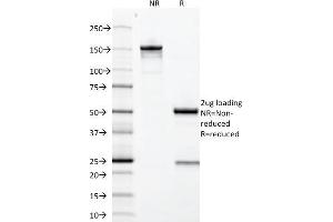SDS-PAGE Analysis Purified Growth Hormone Mouse Monoclonal Antibody (GH/1371). (Growth Hormone 1 anticorps  (AA 58-187))