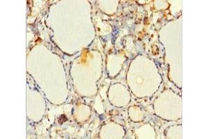 Immunohistochemistry of paraffin-embedded human thyroid tissue using ABIN7151346 at dilution of 1:100 (EML2 anticorps  (AA 1-418))