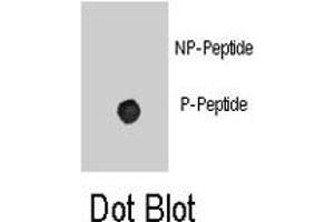 Dot blot analysis of ADRB2 (phospho S261) polyclonal antibody  on nitrocellulose membrane. (beta 2 Adrenergic Receptor anticorps  (pSer261))
