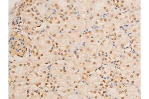 ABIN6267237 at 1/100 staining mouse kidney tissue sections by IHC-P.