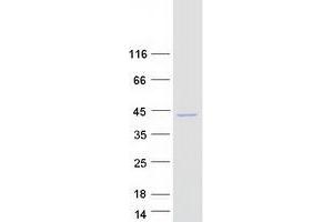 Validation with Western Blot