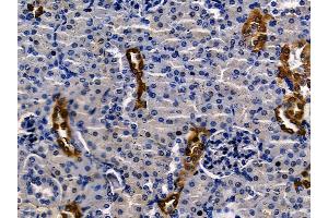 ABIN7094586 and ABIN7098635 at 1/100 staining mouse kidney tissue by IHC-P.