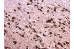 IHC-P Image Scaffold attachment factor B1 antibody detects Scaffold attachment factor B1 protein at nucleus on rat fore brain by immunohistochemical analysis.