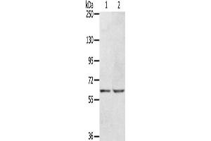 Gel: 6 % SDS-PAGE, Lysate: 40 μg, Lane 1-2: Hepg2 cells, HT29 cells, Primary antibody: ABIN7129957(KCNH6 Antibody) at dilution 1/400, Secondary antibody: Goat anti rabbit IgG at 1/8000 dilution, Exposure time: 30 seconds (KCNH6 anticorps)