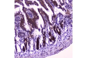 IHC analysis of FLIP using anti-FLIP antibody (ABIN5693075). (FLIP anticorps  (AA 1-376))