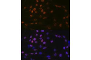 Immunofluorescence analysis of C6 cells using K/H Rabbit mAb (ABIN7267702) at dilution of 1:100 (40x lens).