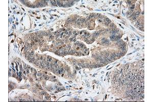 Immunohistochemical staining of paraffin-embedded Human Kidney tissue using anti-IGF2BP2 mouse monoclonal antibody. (IGF2BP2 anticorps)