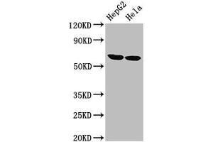 Western Blot Positive WB detected in: HepG2 whole cell lysate, Hela whole cell lysate All lanes: CKAP4 antibody at 2. (CKAP4 anticorps  (AA 260-394))