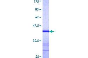 Image no. 1 for alpha-Fetoprotein (AFP) (AA 500-609) protein (GST tag) (ABIN1344538)