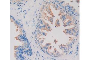 IHC-P analysis of Human Prostate Gland Tissue, with DAB staining. (HIF1AN anticorps  (AA 2-349))