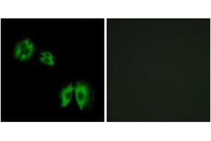 Immunofluorescence analysis of A549 cells, using B3GALT2 Antibody.